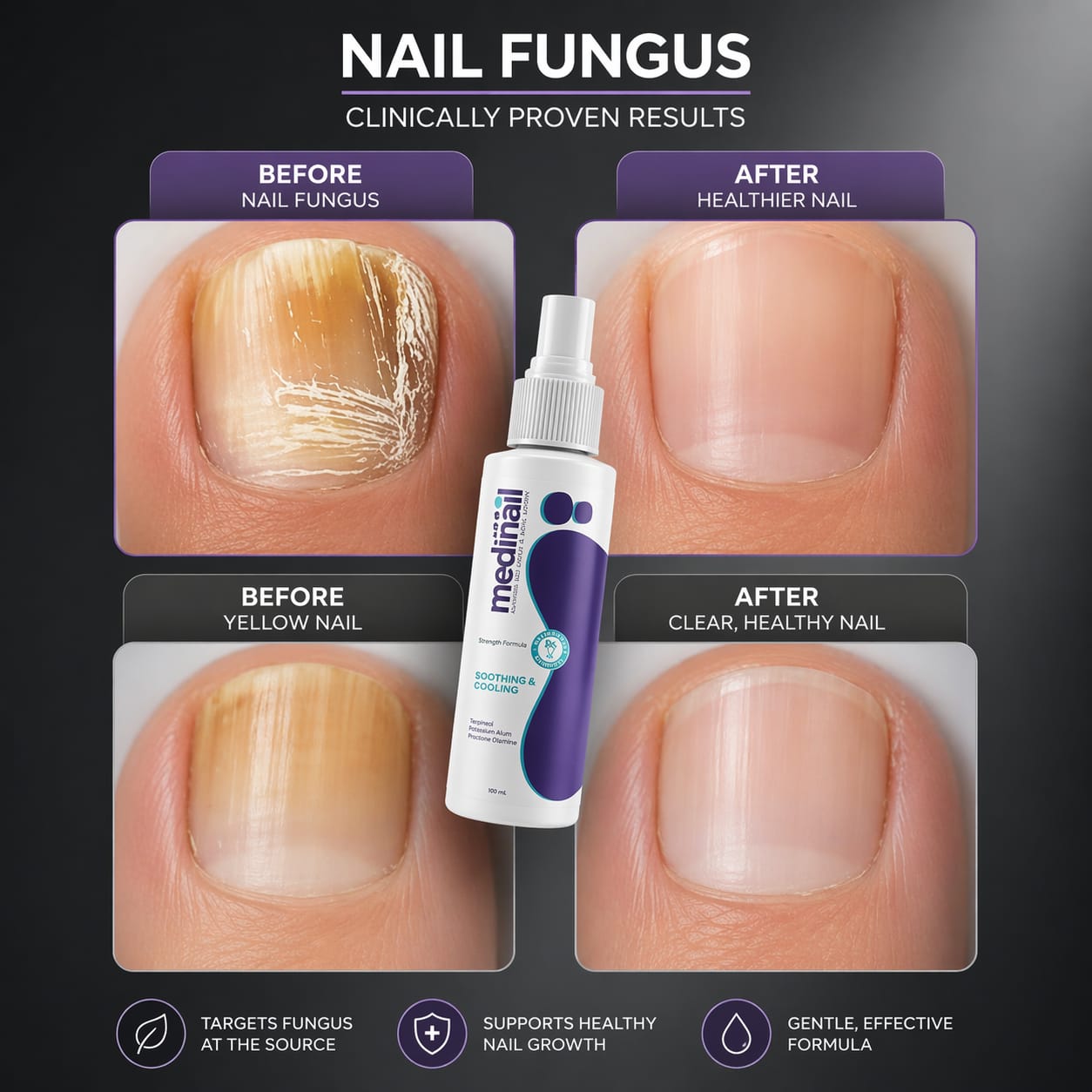 Foot & Nail Care Spray